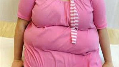 السمنة على رأسها.. 