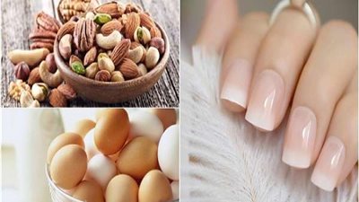 حوار.. خبيرة تغذية: 10 أطعمة للحفاظ على صحة الأظافر.. وهذا علاج البقع البيضاء
