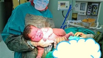 ولادة طفل ضخم بقنا يزن 6 كيلو.. والدته تعاني من هذا المرض