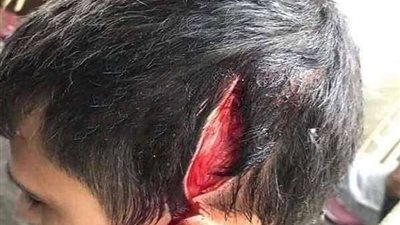 كيس عصير يتسبب في محاولة ذبح طالب إعدادي بـ