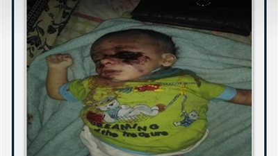 إيداع قاتلة رضيعها بريموت التليفزيون في مستشفى الأمراض النفسية 45 يوما