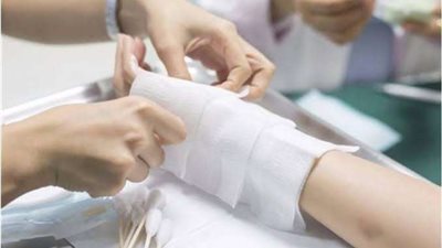 في 5 ثوان.. كيف قضت العناكب على الغرز الطبية