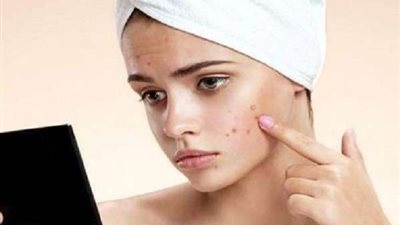 استشاري جلدية يعرض 