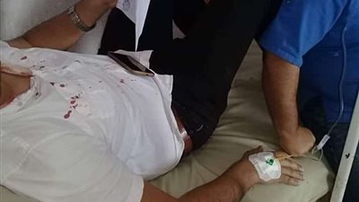 نقابة الأطباء: الاعتداء على طبيب أطفال بمستشفى التل الكبير في الإسماعيلية