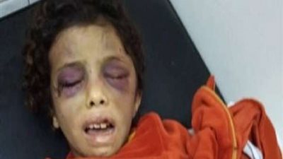 نيابة بلبيس تطلب تقريرا مفصلا عن حالة الطفلة 