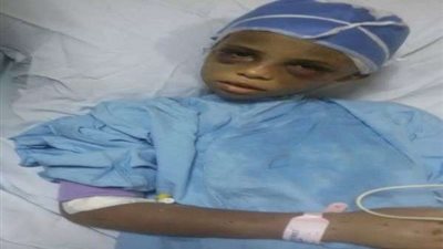 النيابة تستدعي والدة الطفلة المعذبة على يد