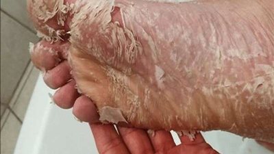 بمكون واحد.. أسهل طريقة لتقشير 