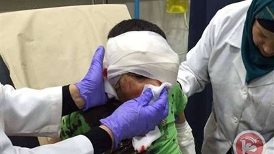 مواطن مصاب بطلق ناري في الوجه يستغيث بالرئيس السيسي