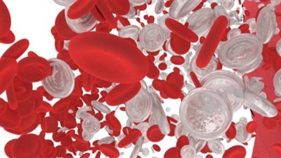 قصة مثيرة.. عائلة هولندية يتحول دمها إلى لون الحليب