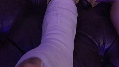 ولي أمر يتهم معلمة بكسر قدم نجل شقيقه بالعصا في الدقهلية