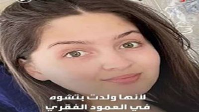حكم قضائي يثأر لـ فتاة من طبيب أصابها بعاهة مستديمة.. فيديو