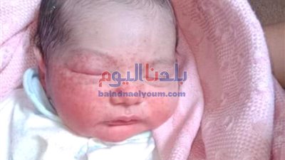 أستاذ علوم غذائية: هناك أنواع من الألبان تقلل من نسبة الإعاقة