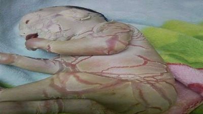 بعد نشر قصتها على 