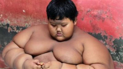أثقل طفل فى العالم يخسر 120 كيلوجراما من وزنه