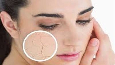 أبرزها ضمور الجلد.. 10 أضرار لـ