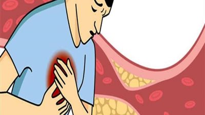 حوار.. استشاري: 4 مخاطر لارتفاع الكوليسترول في الدم.. وهذه طرق علاجه