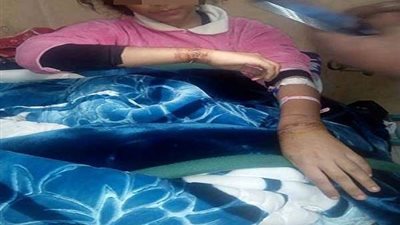 أمن الشرقية يكشف تفاصيل واقعة تعذيب طفلة على يد والدها