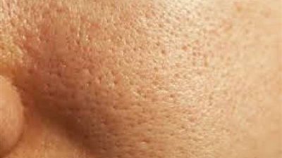 أسباب تؤدي لوجود 