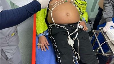 يعاني من مرض نادر .. تعرف على تطورات الحالية الصحية لحمو بيكا