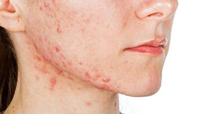 حوار.. أخصائية: 