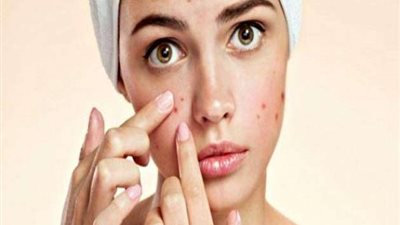 حوار.. استشاري: الهاتف المحمول والإجهاد وراء حب الشباب.. و3 تقنيات حديثة للعلاج