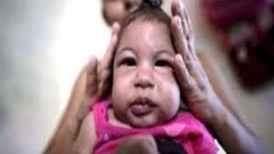 يهاجم الأطفال خلال السنة الأولى من حياتهم.. دراسة تكشف خطر فيروس 