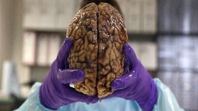 شاب يُجمد دماغ والدته أملا في عودتها للحياة مرة أخرى