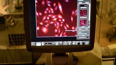 تطبيق ينقذ حياتك.. كيف يمكنك معرفة إذا كنت مصابا بسرطان أم لا؟