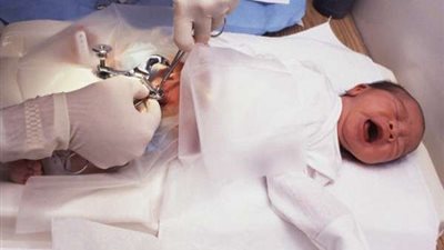 كارثة من عدم ختان الذكور يتسبب فى هذا المرض.. أمجد الحداد يوضح.. فيديو