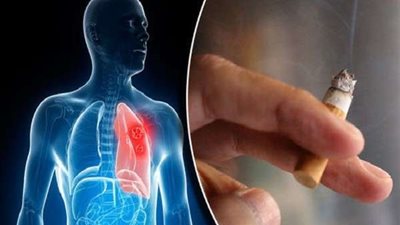 طرق مبتكرة لعلاج العقم عند الرجال