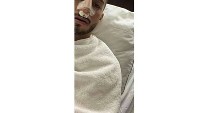 إنهاء محمد عبدالمنعم من جراحه كسر الأنف و رامي ربيعه يطير إلي السنغال