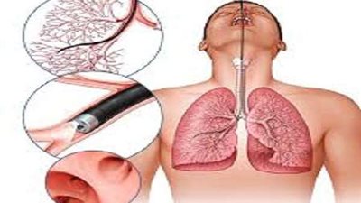 دراسة: الرئة تستبدل الخلايا السرطانية بأخرى صحية بعد ترك التدخين