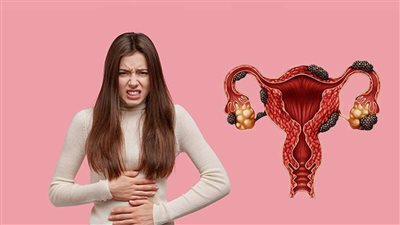 أول تعليق من الشركة المستوردة لـ شوكولاتة الخشخاش