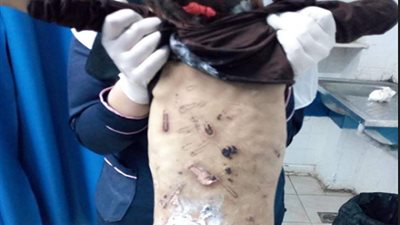 جنايات المنصورة تُصدر حكمها النهائي بشأن جدة الطفلة جنى