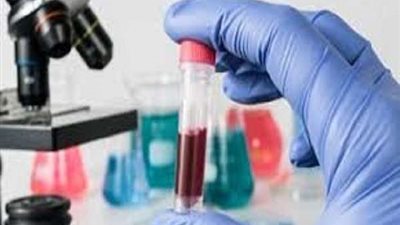 في 9 نقاط.. كيف تقي نفسك من عدوى الأمراض خلال الاتصال الجنسي؟