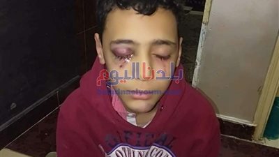 إصابة طفل سقط في ترعة عقب خروجه من المدرسة بشبرا الخيمة