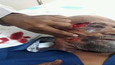 جريمة مروعة.. تفاصيل القبض على آكل لحوم البشر