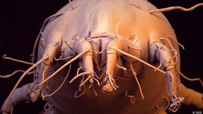 أعراضه حكة في العين.. احذر هذا العدو أثناء النوم على السرير