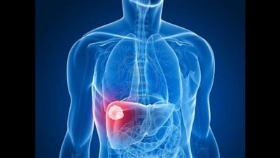 تعرف عليهم.. 5 أطعمة تنظف الكبد من السموم