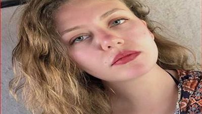 بعد حادثة رحمة حسن.. تعمل ايه لو كلب عضك