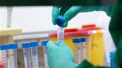 الأرجنتين تسجل 86 إصابة بكورونا خلال 24 ساعة