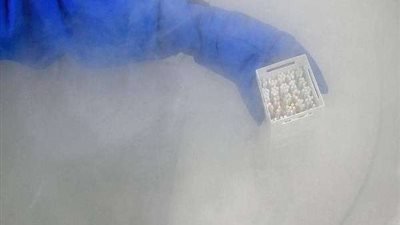 استشاري نساء وتوليد يكشف أسباب اللجوء إلى تجميد الحيوانات المنوية (فيديو)