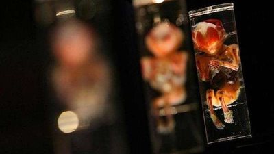 المحكمة الأمريكية العليا تحظر حق المرأة فى الإجهاض