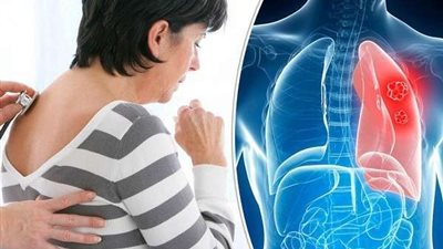 للنساء.. عادات يومية تسبب مشاكل بالرئة