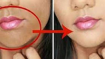 6 خطوات بسيطة للتخلص من الاسمرار حول الفم