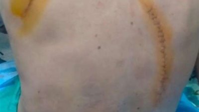 الأطباء تخاطب النائب العام و وزير الداخلية وأمن الدقهلية لحماية طبيب وأسرته