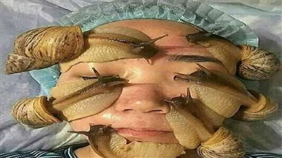 الحلزونات تهدد البشر بنقل عدوى جديدة على شاطى فلوريدا