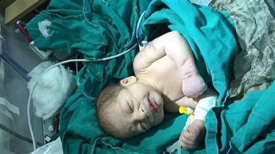 مفاجأة.. الرضاعة تحمي من فيروس كورونا