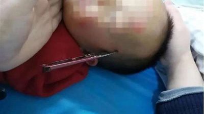 حكاية طفل كاد أن يفقد حياته بسبب والدته (صور)