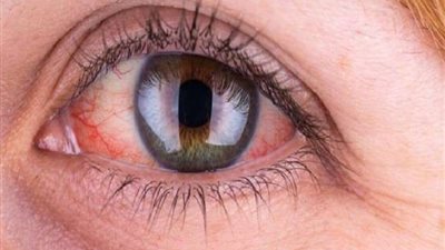 دراسة تكشف صلة قرابة بين أصحاب العيون الزرقاء